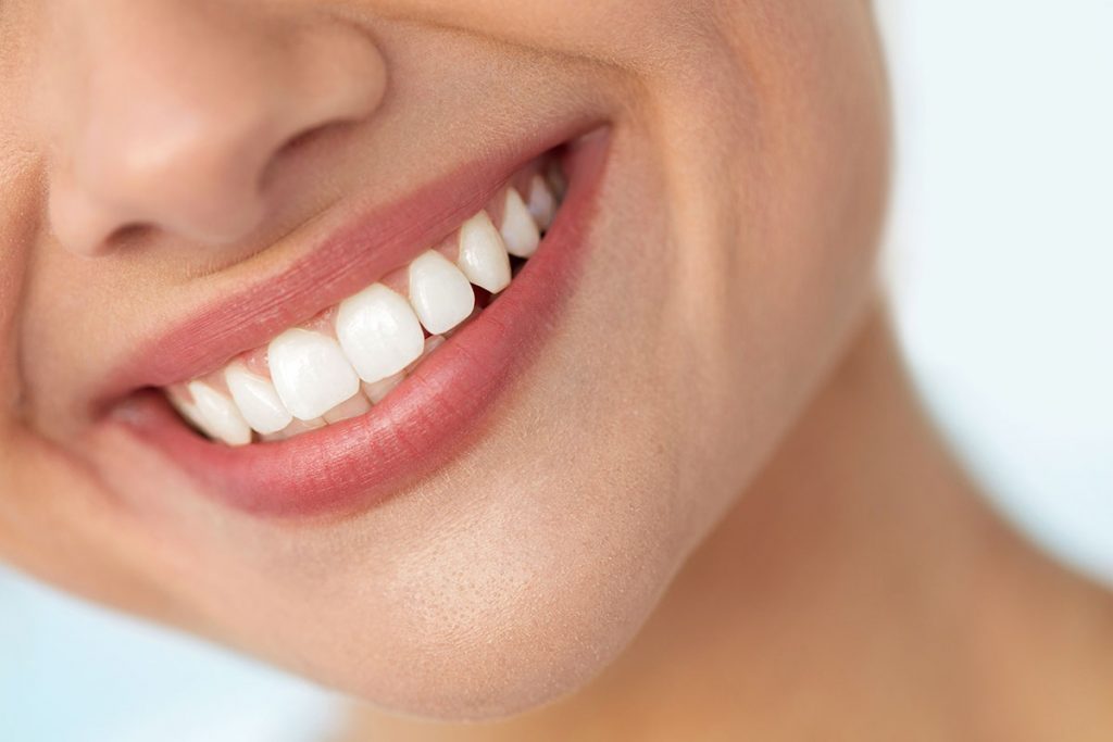 dents de sagesse